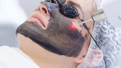 تقشير الوجه بالليزر : أنواعه، فوائده وأضراره