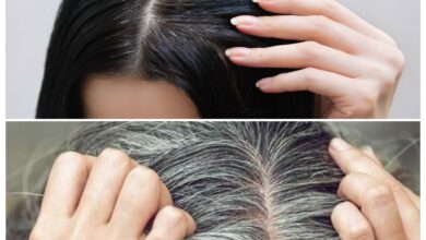 ماهو سبب الشيب المبكر ، وماهو علاجه 11 ماهو سبب الشيب المبكر ، وماهو علاجه